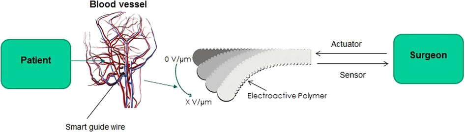 Bernard Actuator Wiring Diagram Development Of A Smart Guide Wire Using An Electrostrictive Polymer