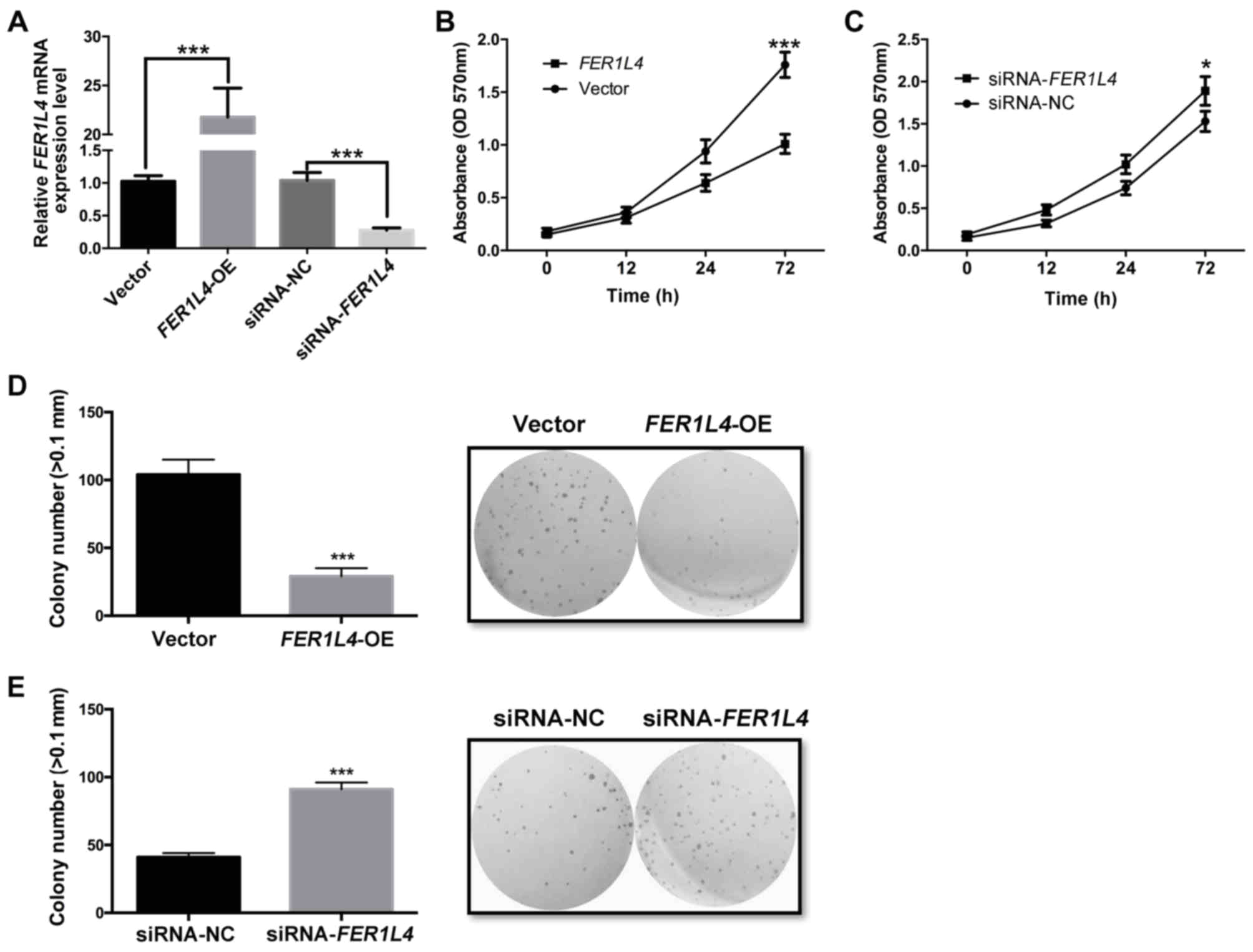 Kim Hotstart Wiring Diagrams Long Non Coding Rna Fer 1 Like Family Member 4 Suppresses Kim Hotstart Wiring Diagrams Long Non Coding Rna Fer 1 Like Family Member 4 Suppresses