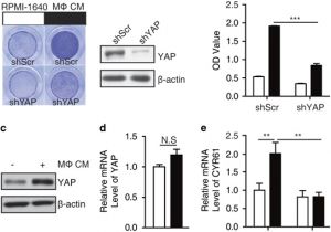 791 bypass Module Wiring Diagram Tnfi Yap P65 Hk2 Axis Mediates Breast Cancer Cell Migration 791 bypass Module Wiring Diagram Tnfi Yap P65 Hk2 Axis Mediates Breast Cancer Cell Migration
