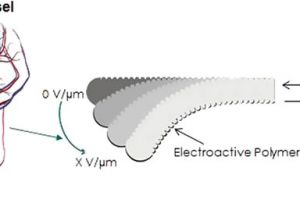 Bernard Actuator Wiring Diagram Development Of A Smart Guide Wire Using An Electrostrictive Polymer