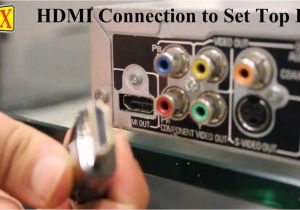 Cable Box Wiring Diagram How to Connect A Set top Box to Tv Hdtv Lcd Led Plasma or Smart Tv Cable Box Wiring Diagram How to Connect A Set top Box to Tv Hdtv Lcd Led Plasma or Smart Tv