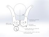 Fantastic Vent Fan Wiring Diagram Mechanical Mit E Vent Mit Emergency Ventilator