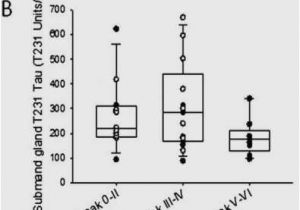 Kenwood Kmr D365bt Wiring Diagram 5 1 Car Amplifier Wiring Diagram Akumal Us