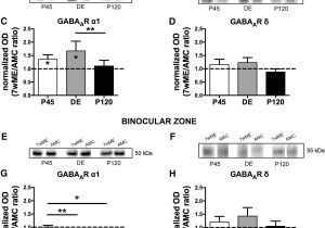 Ready Remote 21994 Wiring Diagram Regional Specificity Of Gabaergic Regulation Of Cross Modal