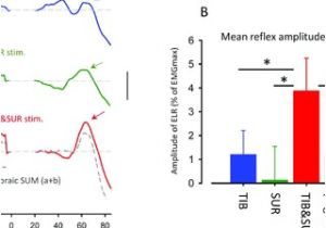 Sole F63 Wiring Diagram Convergence Effect Of Simultaneous Sural and Tibial Nerve Sole F63 Wiring Diagram Convergence Effect Of Simultaneous Sural and Tibial Nerve