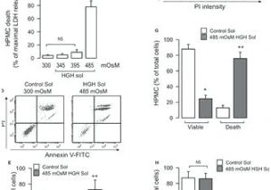 Tekonsha Brake Controller Wiring Diagram Tekonsha Brake Controller Wiring Related Post Wire Diagram Trbo
