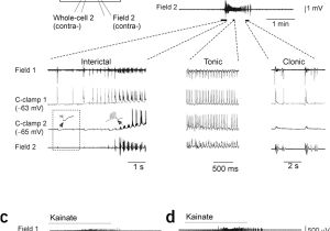 Triple S Customs Wiring Diagrams Free In Vitro formation Of A Secondary Epileptogenic Mirror Focus by